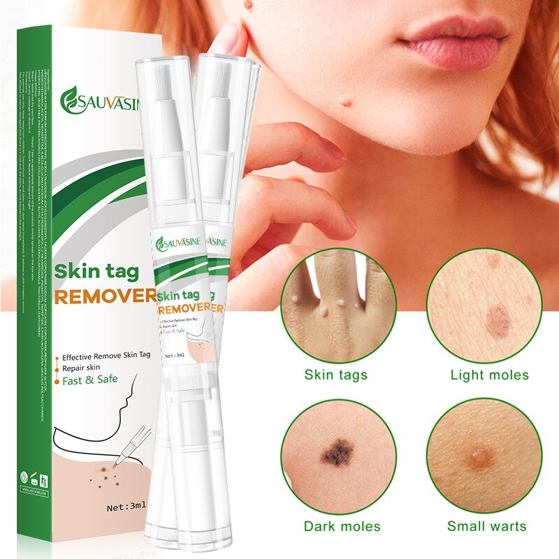 SKIN TAG REMOVER